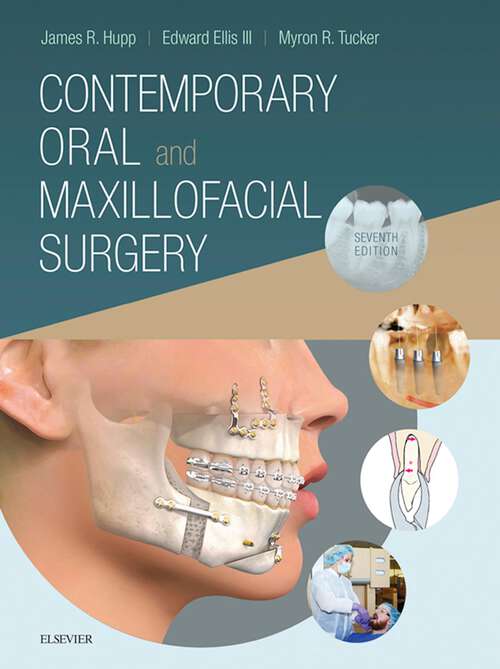 Book cover of Contemporary Oral and Maxillofacial Surgery E-Book: Contemporary Oral and Maxillofacial Surgery E-Book (7)