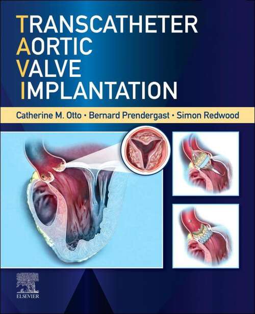 Book cover of Transcatheter Aortic Valve Implantation, E-Book