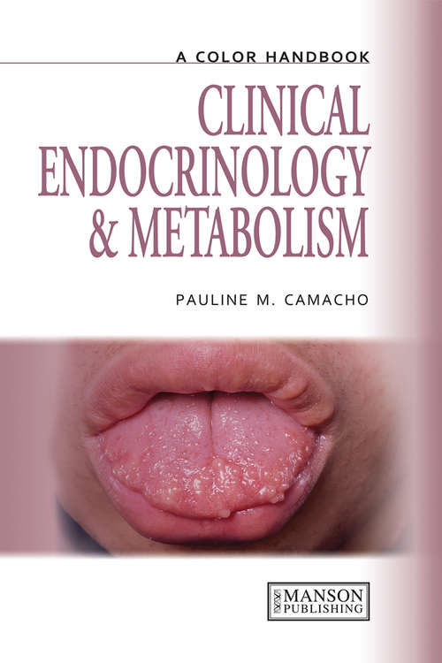 Book cover of Clinical Endocrinology and Metabolism