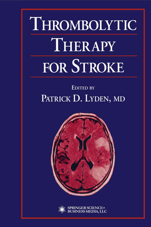 Book cover of Thrombolytic Therapy for Stroke (2001)