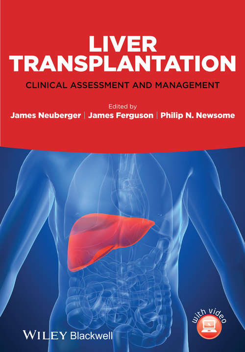 Book cover of Liver Transplantation: Clinical Assessment and Management