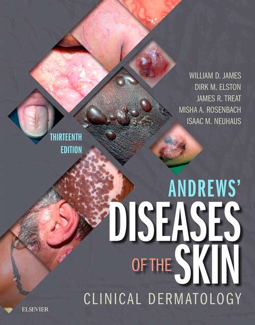 Book cover of Andrews' Diseases of the Skin: Clinical Dermatology (13)