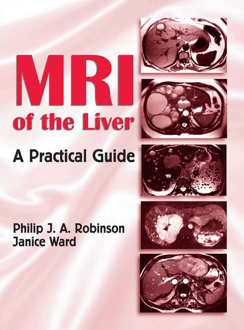 Book cover of MRI of the Liver: A Practical Guide