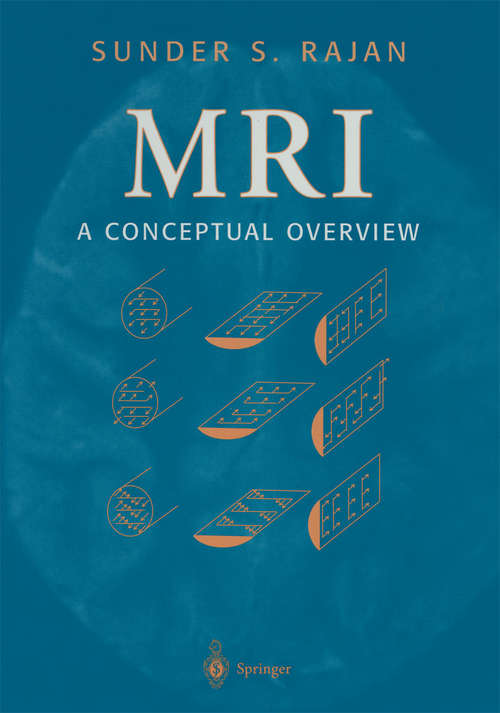 Book cover of MRI: A Conceptual Overview (1998)