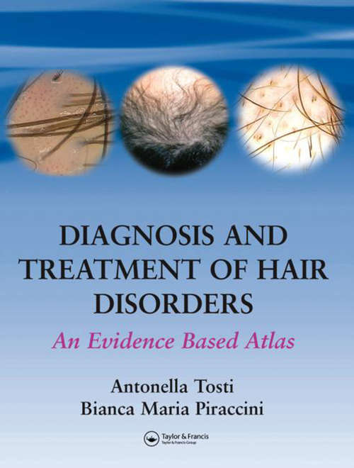 Book cover of Diagnosis and Treatment of Hair Disorders: An Evidence-Based Atlas