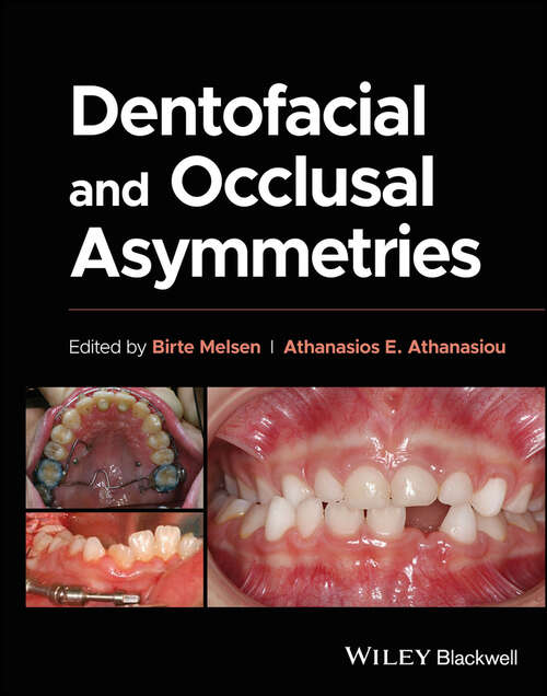 Book cover of Dentofacial and Occlusal Asymmetries