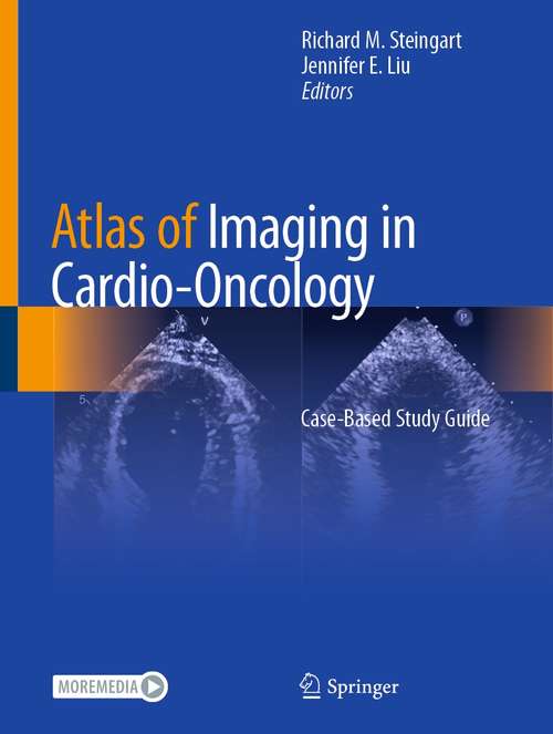 Book cover of Atlas of Imaging in Cardio-Oncology: Case-Based Study Guide (1st ed. 2021)
