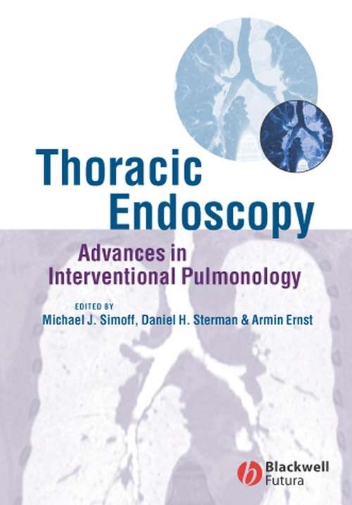 Book cover of Thoracic Endoscopy: Advances in Interventional Pulmonology