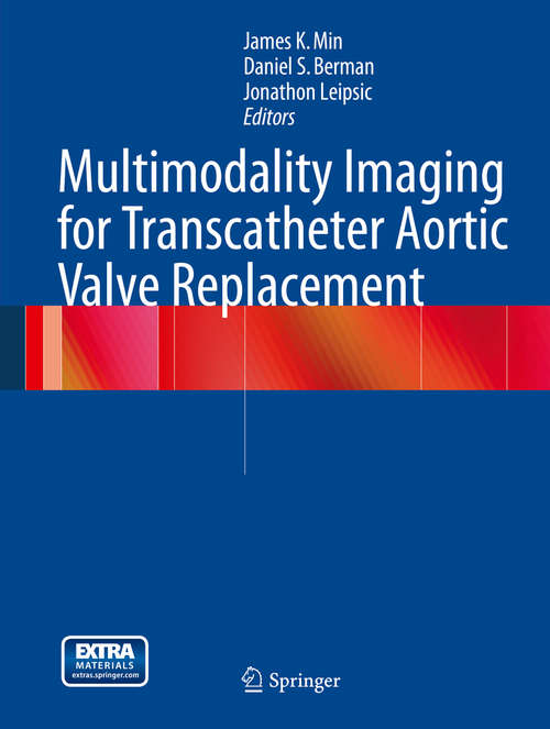 Book cover of Multimodality Imaging for Transcatheter Aortic Valve Replacement (2014)