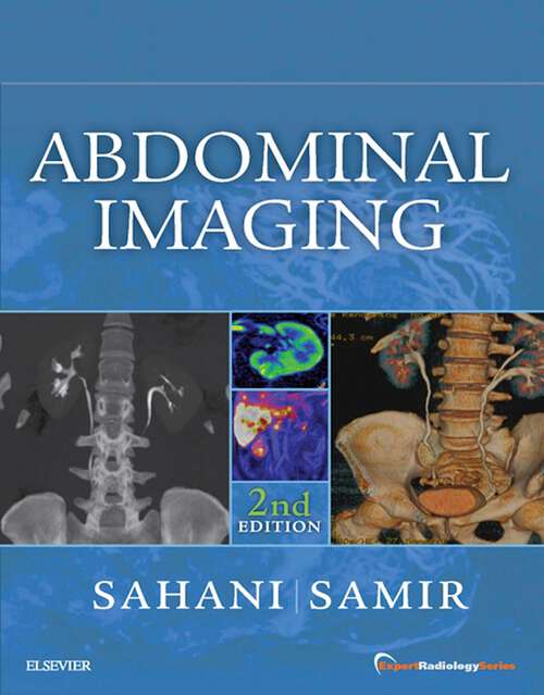 Book cover of Abdominal Imaging E-Book: Expert Radiology Series (2) (Expert Radiology)