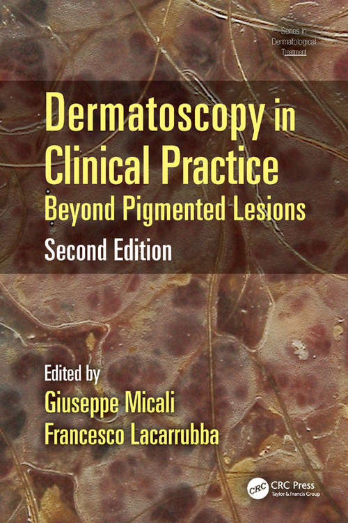 Book cover of Dermatoscopy in Clinical Practice: Beyond Pigmented Lesions (2) (Series in Dermatological Treatment)