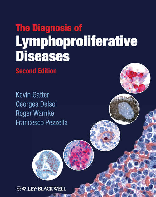 Book cover of The Diagnosis of Lymphoproliferative Diseases (2)