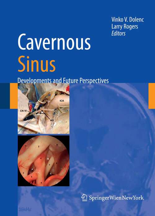 Book cover of Cavernous Sinus: Developments and Future Perspectives (2009)