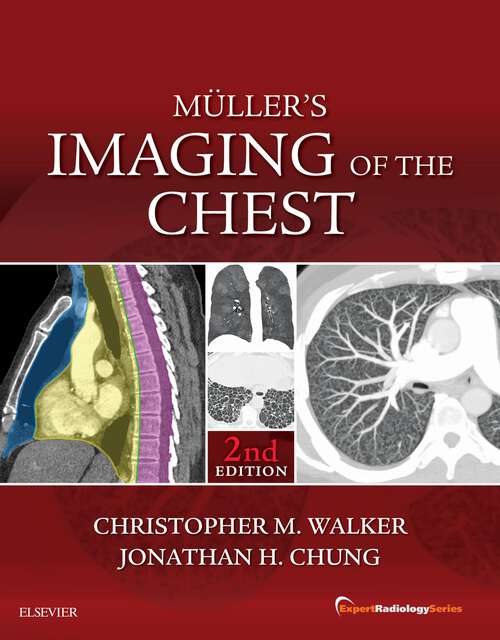 Book cover of Muller's Imaging of the Chest E-Book: Expert Radiology Series (2) (Expert Radiology)