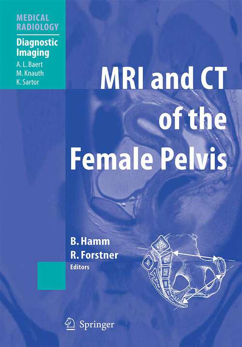 Book cover of MRI and CT of the Female Pelvis (2007) (Medical Radiology)