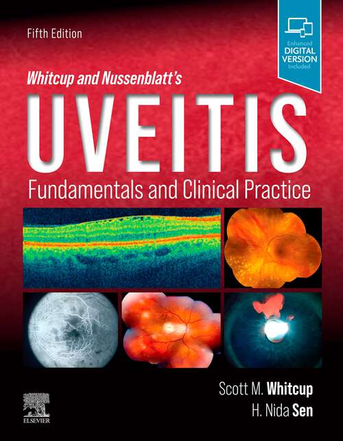 Book cover of Whitcup and Nussenblatt's Uveitis: Fundamentals and Clinical Practice (5)