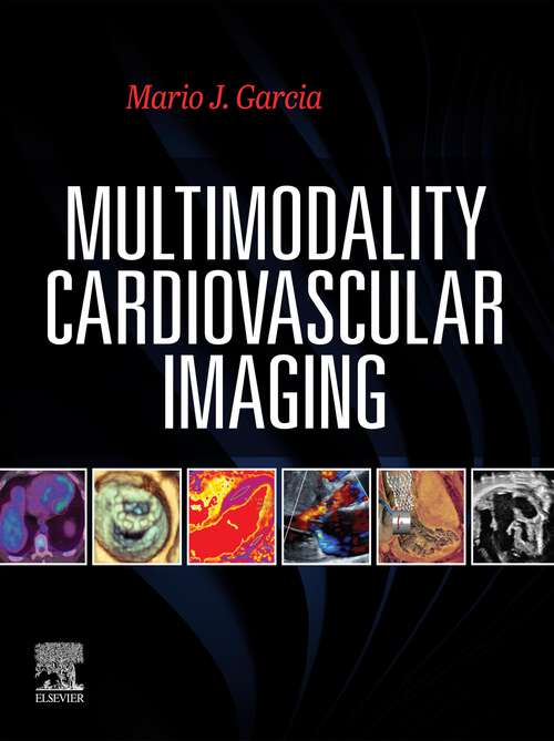 Book cover of Multimodal Cardiac Imaging - E-Book