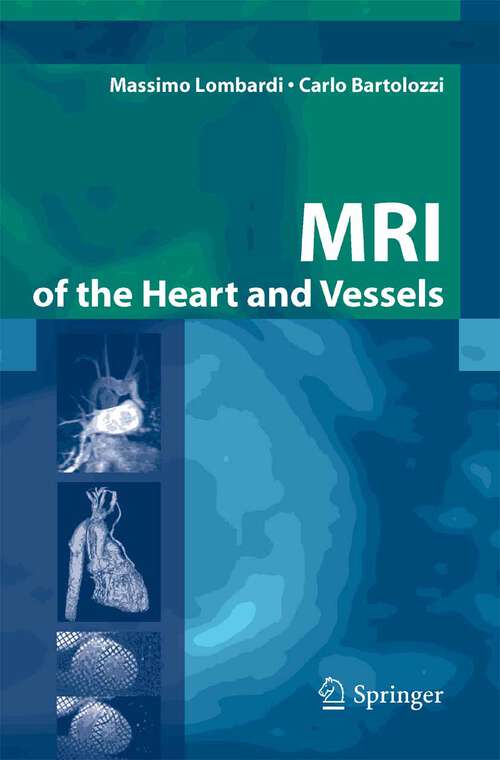 Book cover of MRI of the Heart and Vessels (2005)