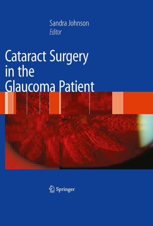 Book cover of Cataract Surgery in the Glaucoma Patient (2009)