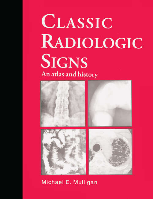 Book cover of Classic Radiologic Signs: An Atlas and History