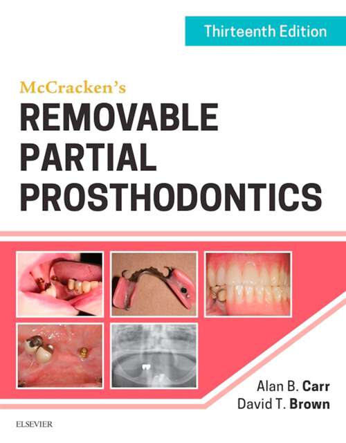 Book cover of McCracken's Removable Partial Prosthodontics (13)