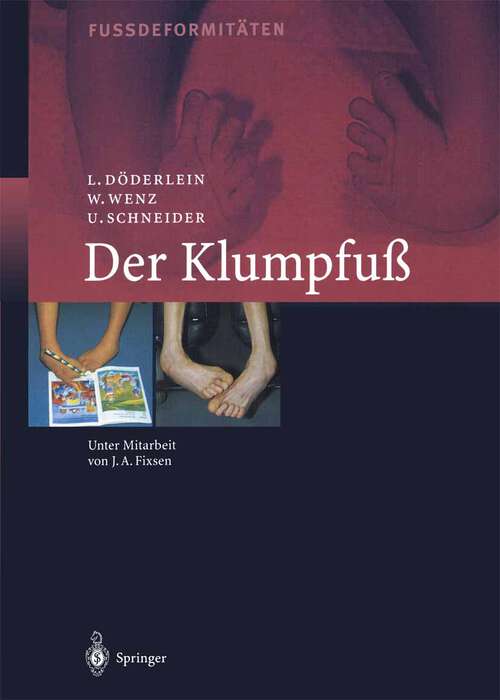 Book cover of Der Klumpfuss: Erscheinungsformen und Behandlungsprinzipien jeden Alters. Differentialdiagnose und Differentialtherapie (1999)