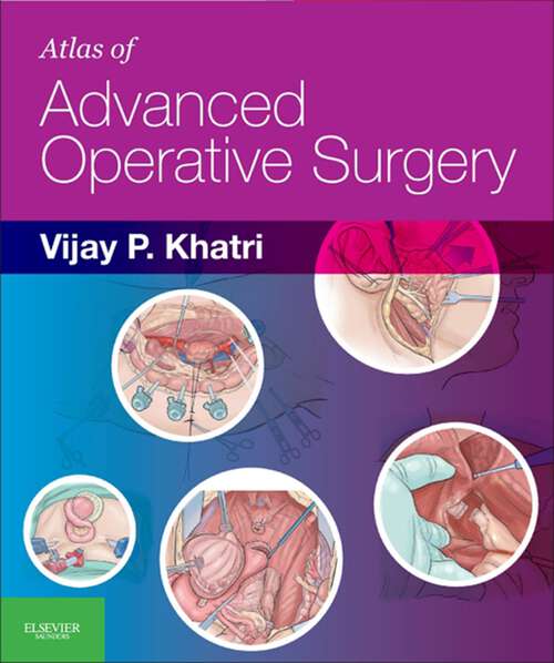 Book cover of Atlas of Advanced Operative Surgery E-Book: Expert Consult - Online and Print