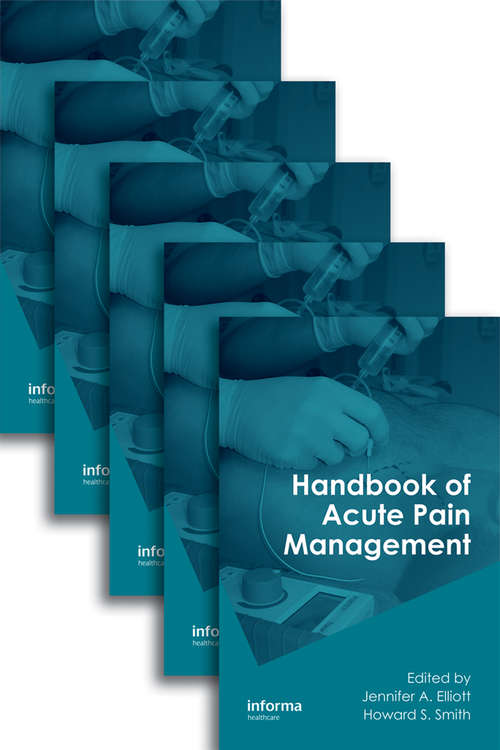 Book cover of Handbook of Acute Pain Management