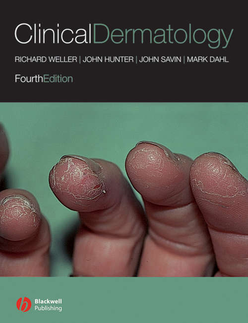 Book cover of Clinical Dermatology (4)