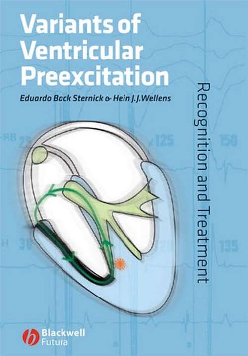 Book cover of Variants of Ventricular Preexcitation: Recognition and Treatment