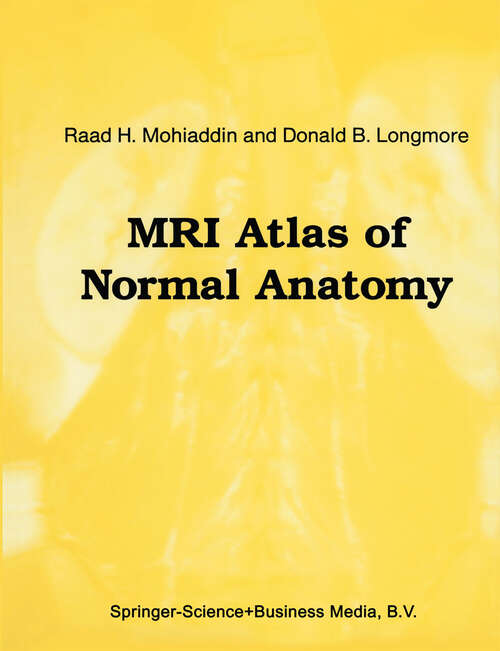 Book cover of MRI Atlas of Normal Anatomy (1992) (Series in Radiology #24)