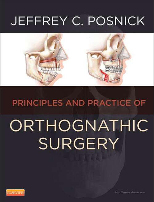 Book cover of Orthognathic Surgery: Orthognathic Surgery