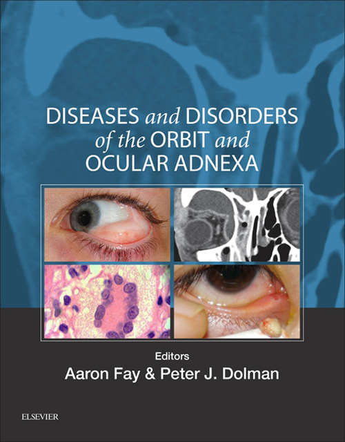 Book cover of Diseases and Disorders of the Orbit and Ocular Adnexa E-Book: Expert Consult