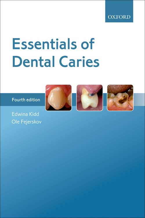Book cover of Essentials of Dental Caries