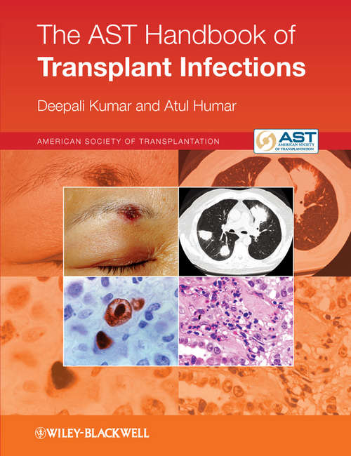 Book cover of The AST Handbook of Transplant Infections (2)