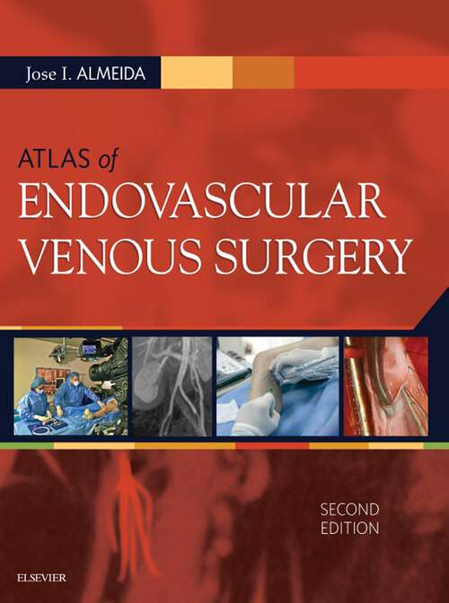 Book cover of Atlas of Endovascular Venous Surgery E-Book (2)