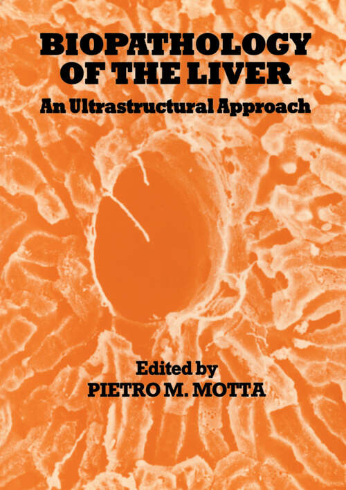 Book cover of Biopathology of the Liver: An Ultrastructural Approach (1988)