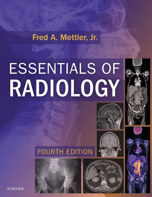 Book cover of Essentials of Radiology E-Book: Common Indications and Interpretation (4)