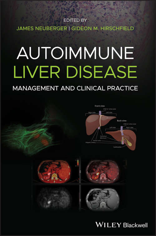 Book cover of Autoimmune Liver Disease: Management and Clinical Practice