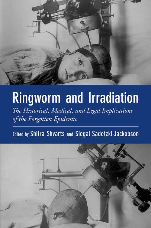 Book cover of Ringworm and Irradiation: The Historical, Medical, and Legal Implications of the Forgotten Epidemic (Oxford Medical Online)