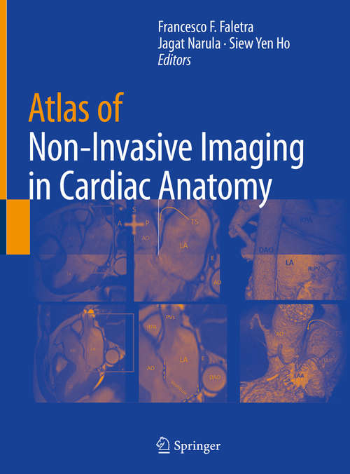 Book cover of Atlas of Non-Invasive Imaging in Cardiac Anatomy (1st ed. 2020)