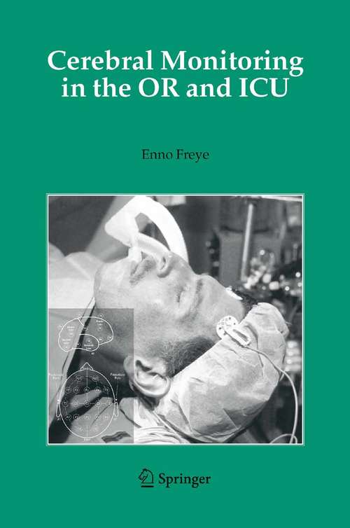 Book cover of Cerebral Monitoring in the OR and ICU (2005)