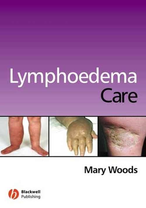 Book cover of Lymphoedema Care