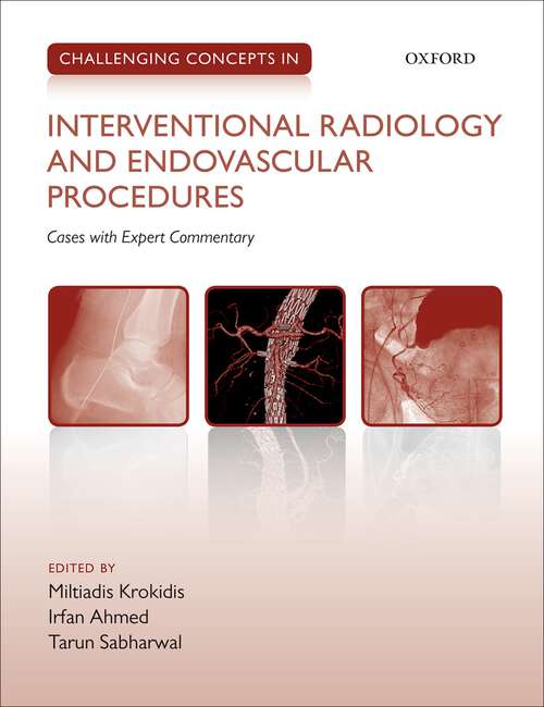 Book cover of Challenging Concepts in Interventional Radiology (Challenging Cases)