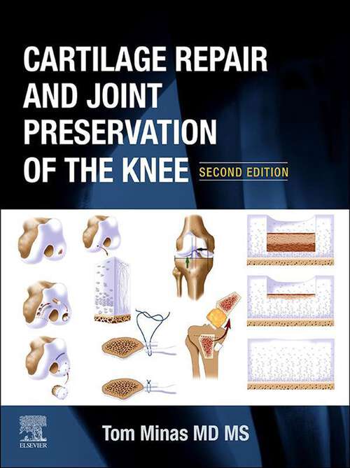 Book cover of Cartilage Repair and Joint Preservation of the Knee: Expert Consult (2)