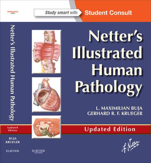 Book cover of Netter's Illustrated Human Pathology Updated Edition E-book: Netter's Illustrated Human Pathology Updated Edition E-book