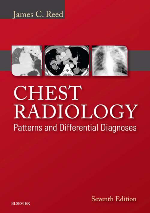 Book cover of Chest Radiology: Patterns And Differential Diagnoses (7)