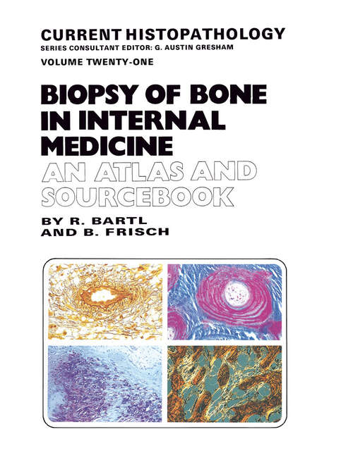 Book cover of Biopsy of Bone in Internal Medicine: An Atlas and Sourcebook (1993) (Current Histopathology #21)