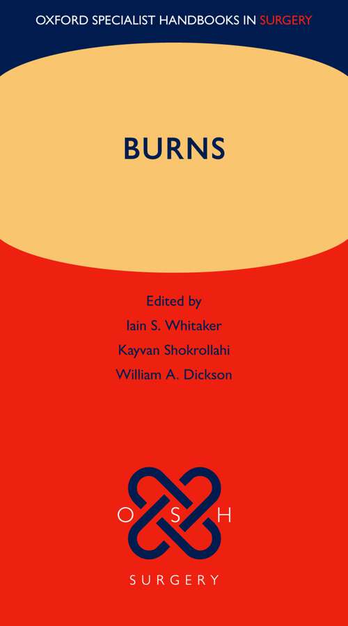 Book cover of Burns (Oxford Specialist Handbooks in Surgery)