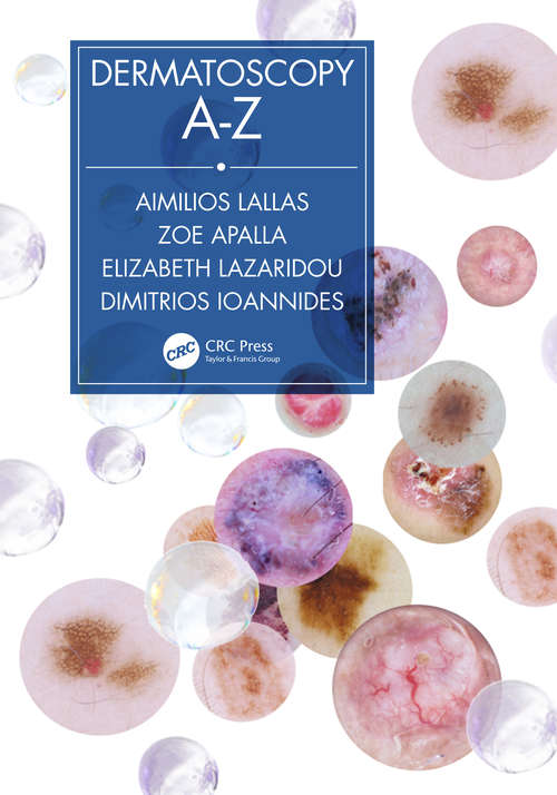 Book cover of Dermatoscopy A-Z